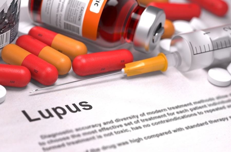 lupus treatments